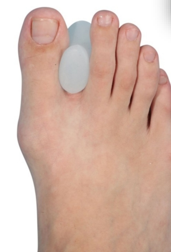 TOE SEPARATOR 105.254